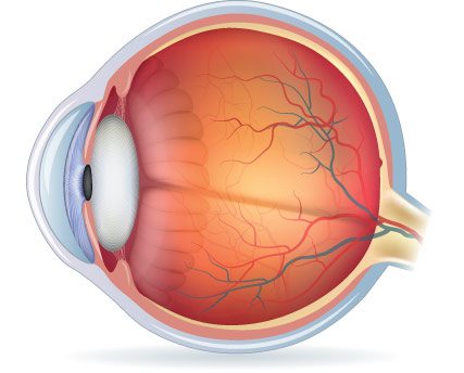 Stages of Dysfunctional Lens Syndrome | Brooks Eye Associates