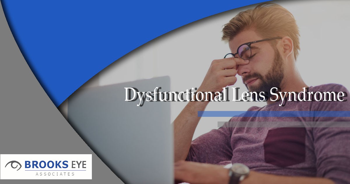 Dysfunctional Lens Syndrome | Brooks Eye Associates